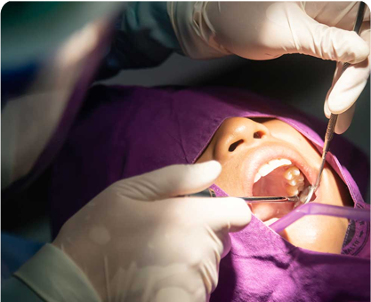 Wisdom Teeth Extraction